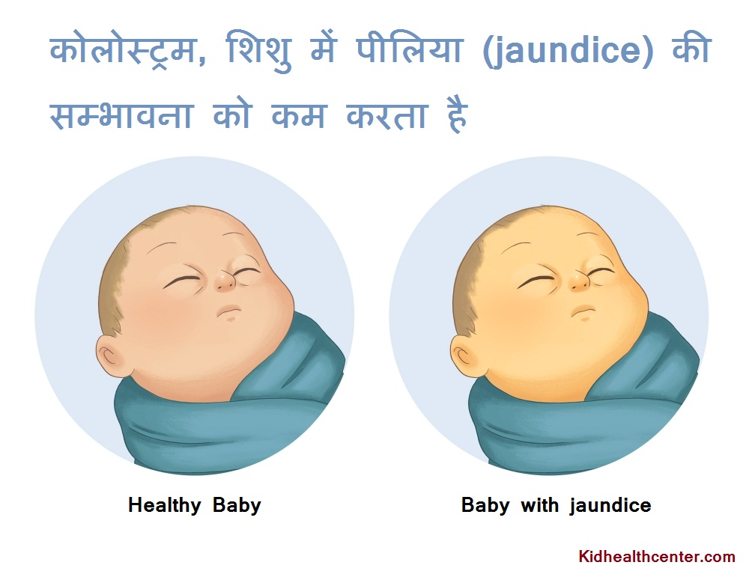 कोलोस्ट्रम पीलिया (jaundice) की सम्भावना को कम करता है